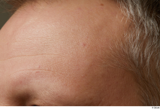 HD Face Skin Agustin Wilkerson face forehead skin pores skin…